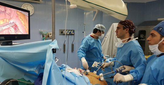 بهترین مدل جراحی چاقی