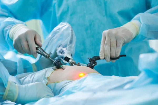 عمل لاپاروسکوپی | چگونه از جراحت عمل خلاص شویم؟
